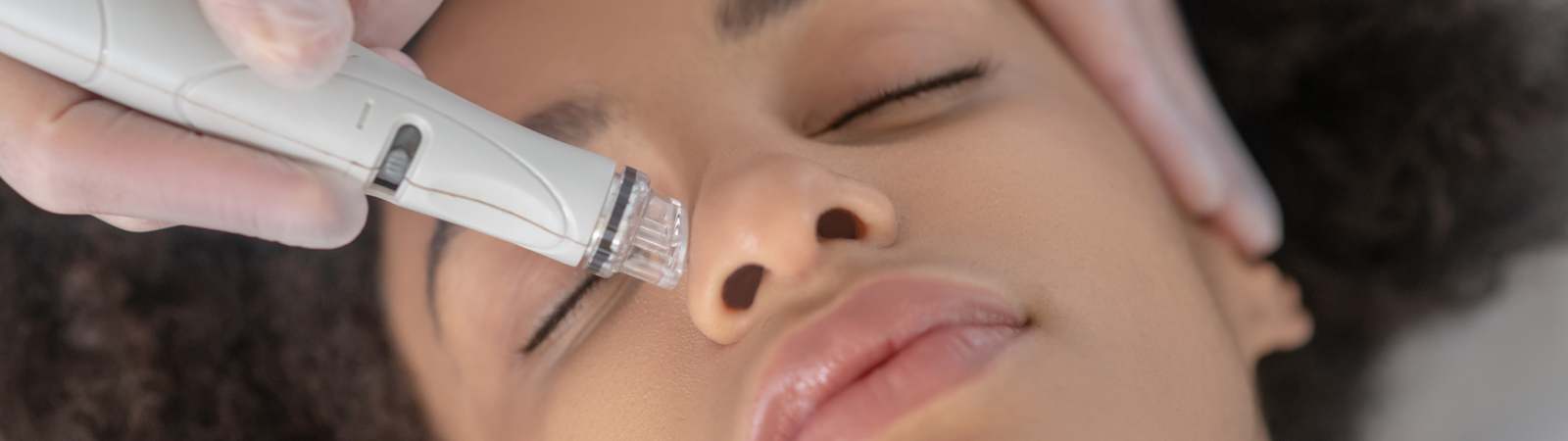 Close-up of a person's face undergoing a cosmetic treatment with a handheld device, held by someone wearing gloves. Their eyes are closed, and the device is applied to their nose.